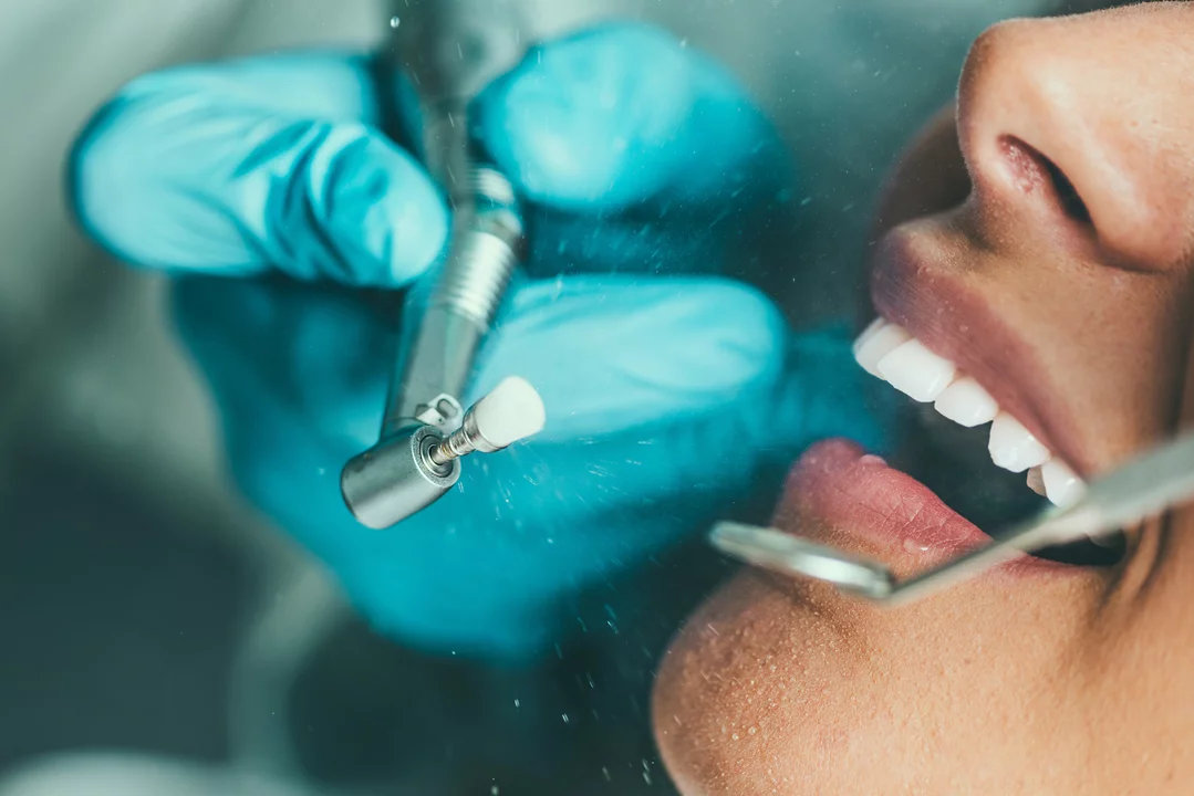 Prophylaxis and Dental Emergencies: How Preventive Care Can Save Your Teeth