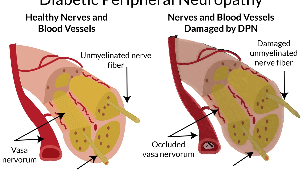 The Importance of Regular Checkups for Diabetic Peripheral Neuropathy Patients